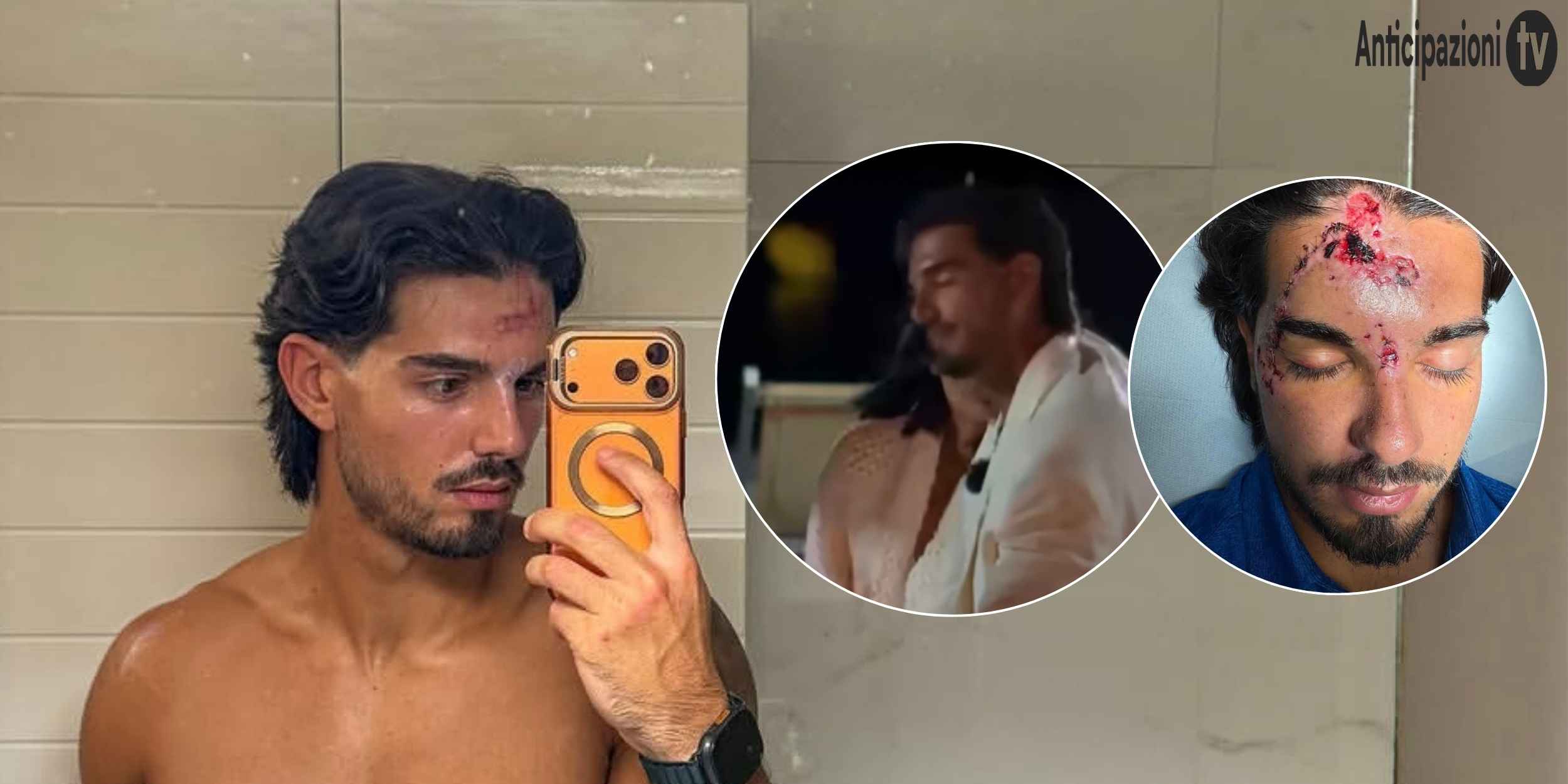 Temptation Island 2026, grave incidente per Marco Fatata: come sta e prime parole del tentatore