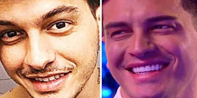 GF Vip, Alessandro Basciano irriconoscibile dopo la chirurgia: tutti gli interventi al viso