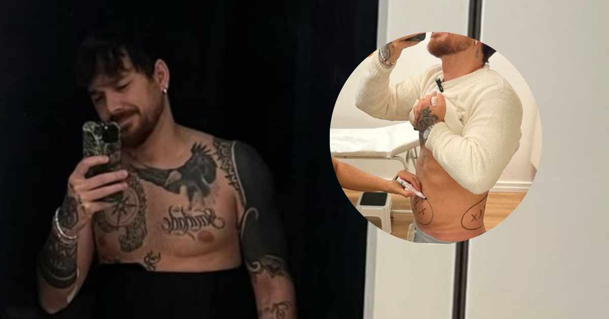 Uomini e Donne: Andrea Cerioli parla dopo la mini-liposuzione