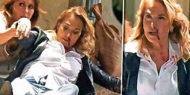 Barbara d’Urso sanguinante e priva di sensi: ecco perchè