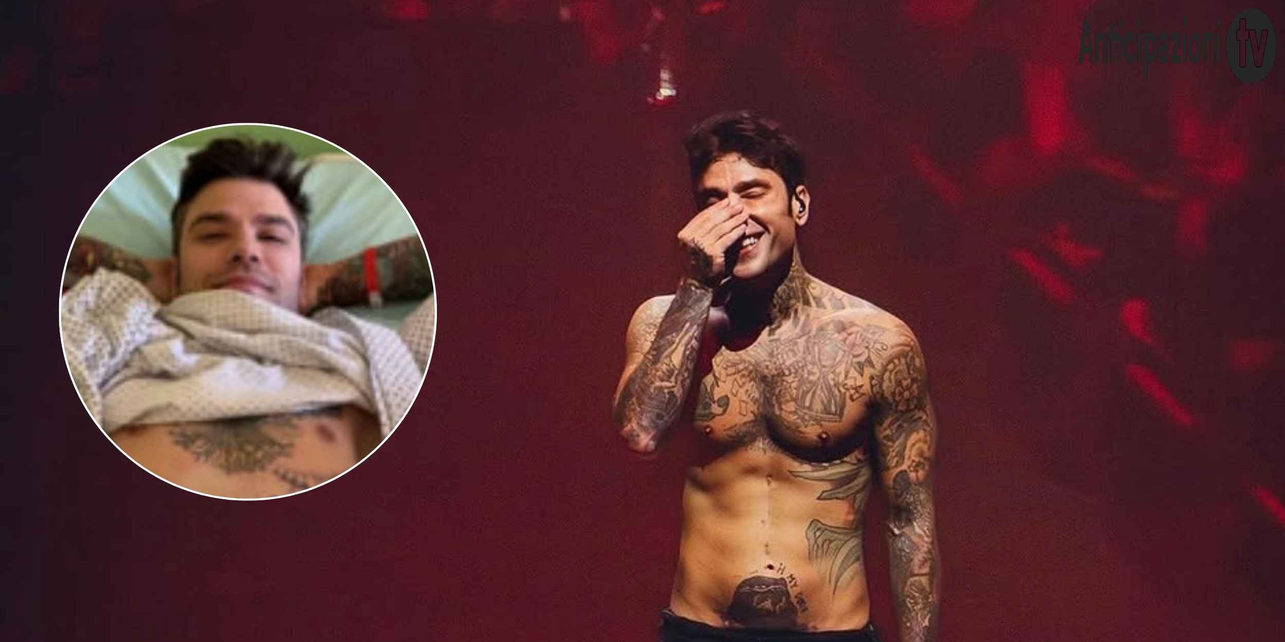 fedez ricoverato d8217urgenza come sta il cantante e il vero motivo da Anticipazionitv.it fedez ricoverato d8217urgenza come sta il cantante e il vero motivo