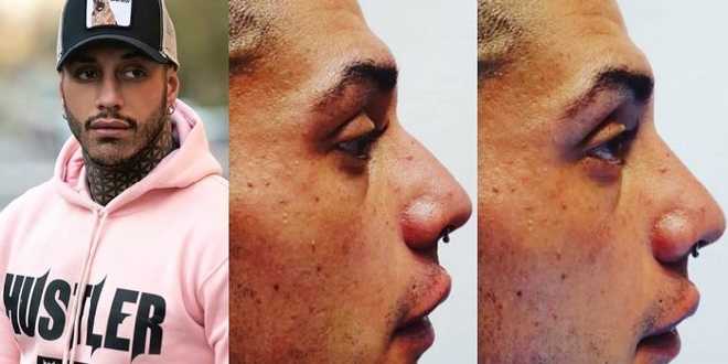 Francesco Chiofalo si rifà in Turchia e il web lo bombarda di insulti