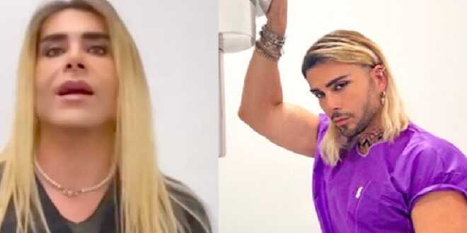 Giacomo Urtis, bufera sull’intervento per migliorare le labbra: “Si vedono solo i denti”