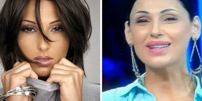 Gossip news: Anna Tatangelo e il ritocco finito male! Ecco la verità