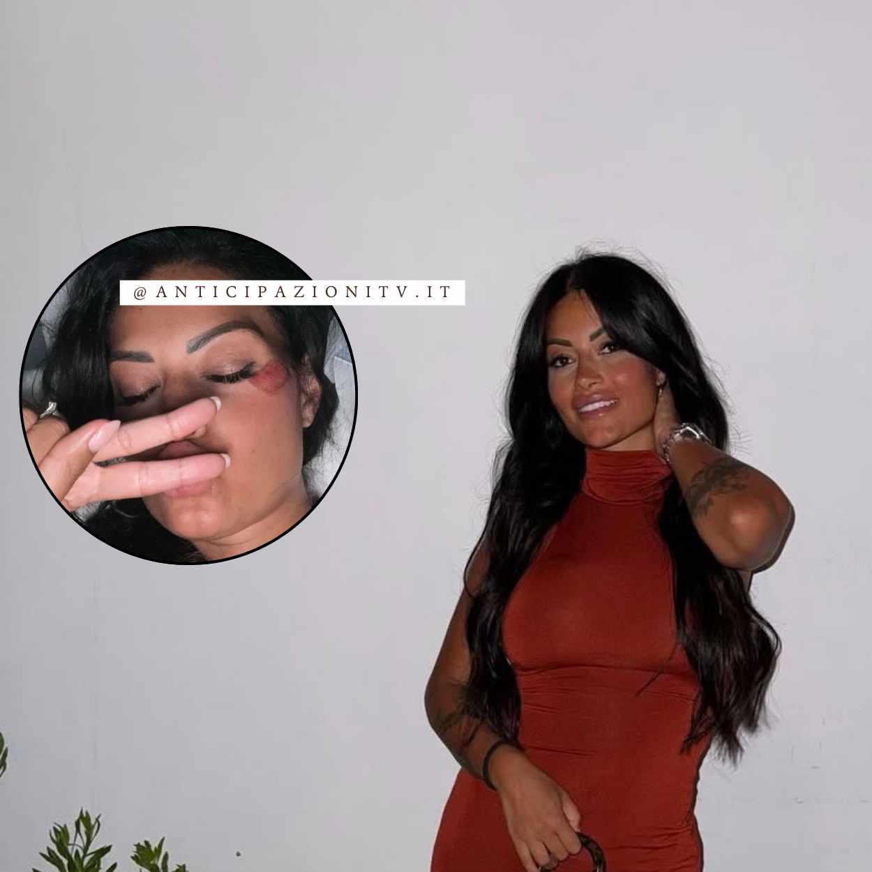 Temptation Island, grave incidente stradale per Alessia Pascarella: ecco come sta