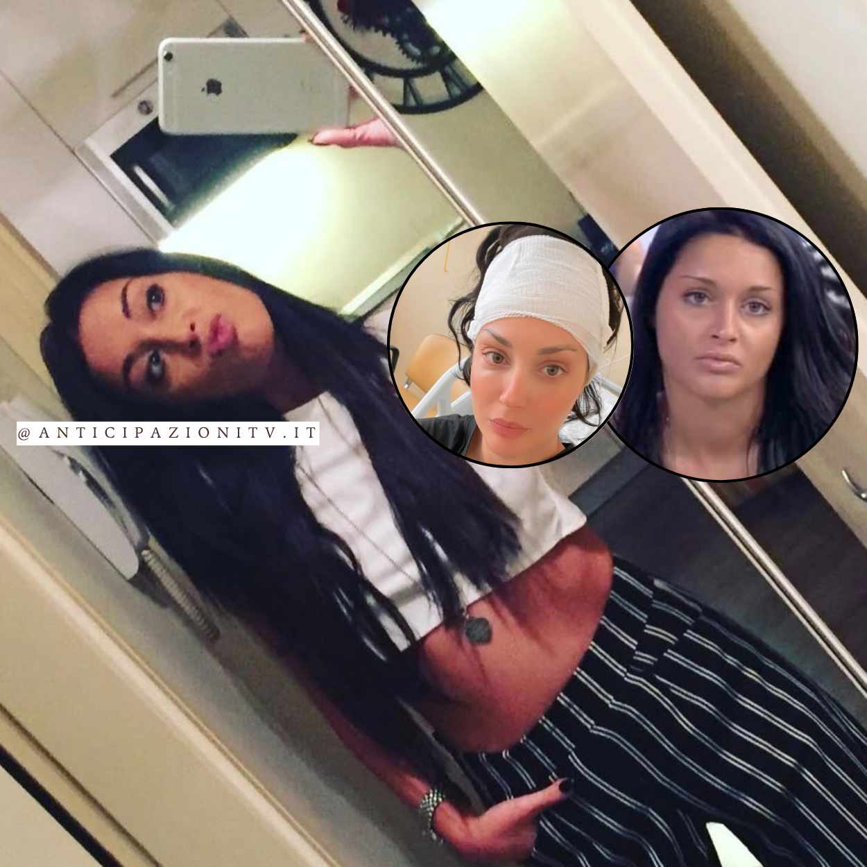 Uomini e Donne, delicato intervento alla testa per Diletta Pagliano: il motivo e le prime parole