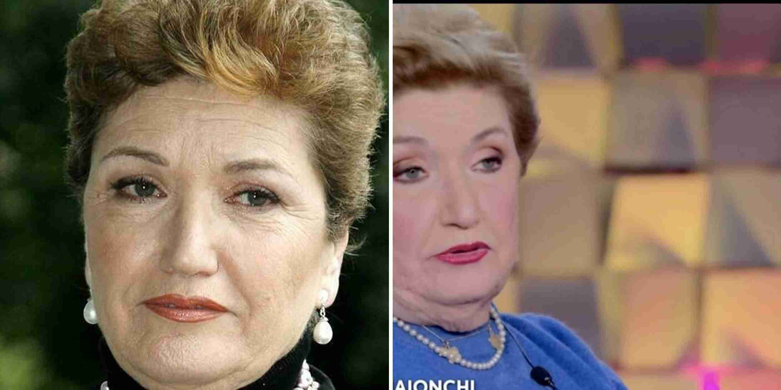 Mara Maionchi racconta la sua battaglia contro la poliomielite a Verissimo