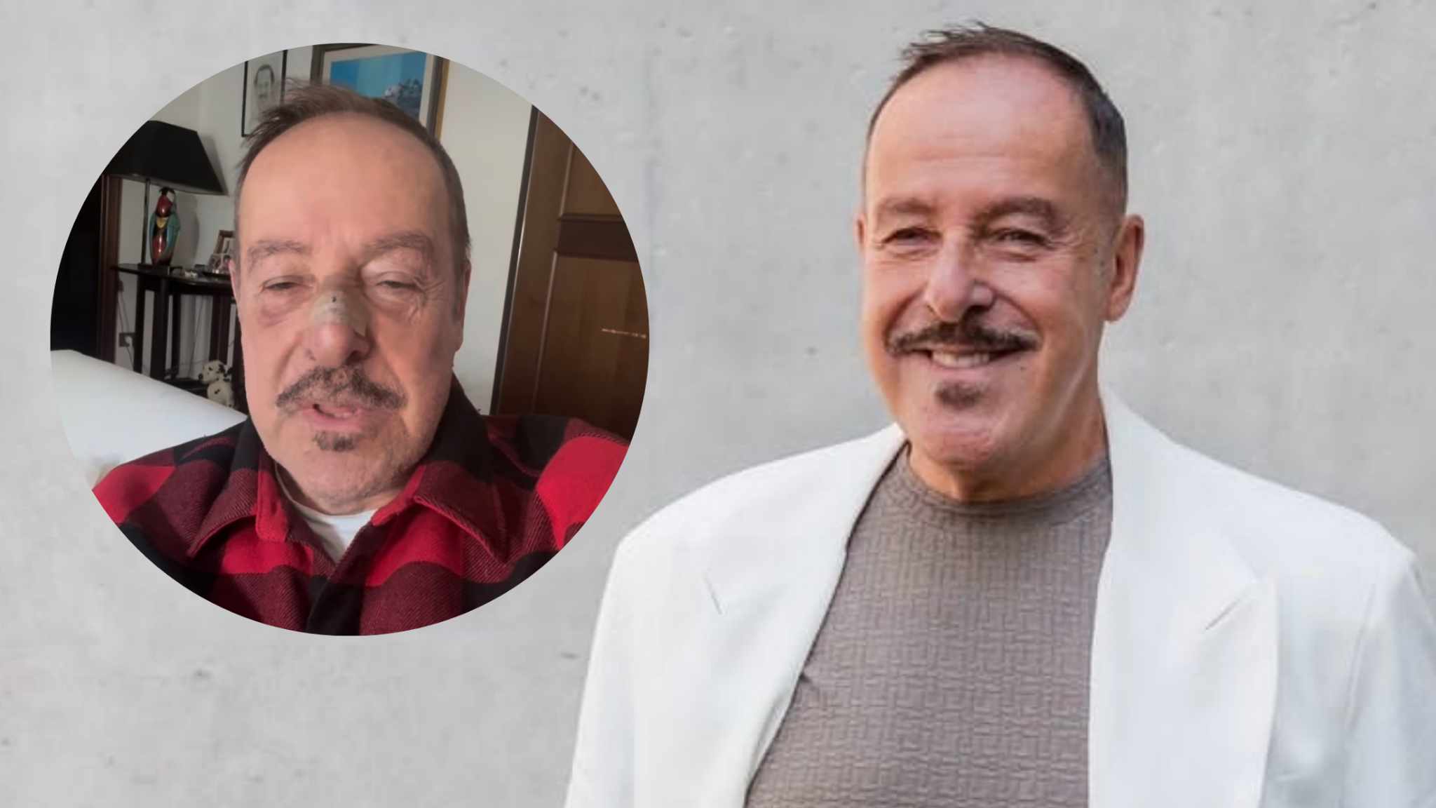 Massimo Lopez investito: il comico racconta l’incidente