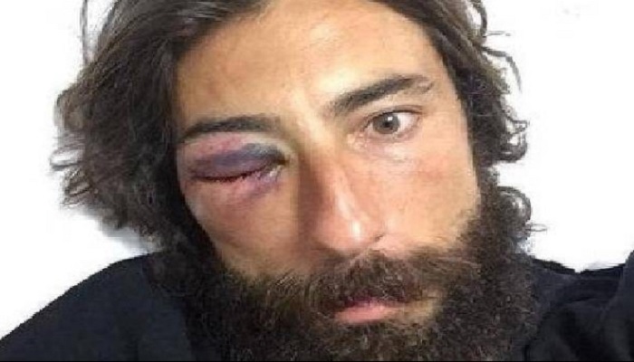 Striscia la Notizia: Vittorio Brumotti picchiato in strada a Pescara!
