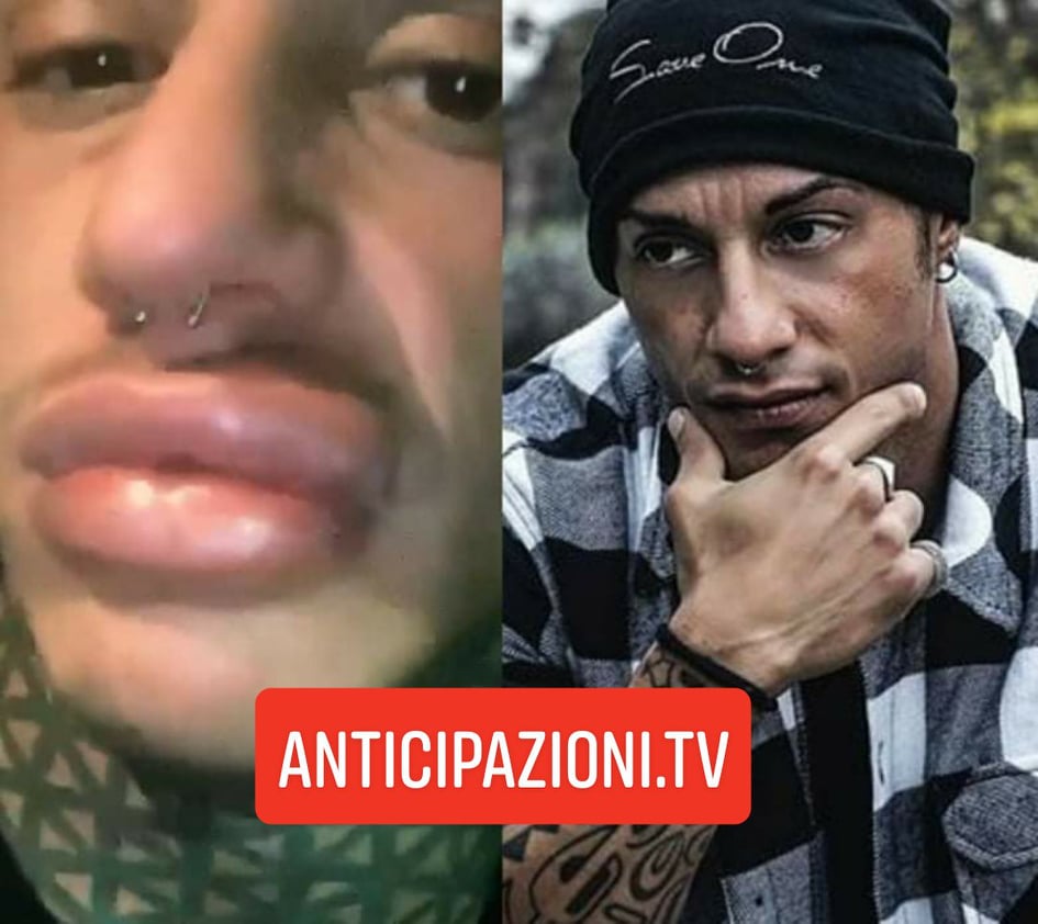 Una testimone smentisce Francesco Chiofalo: “Le sue labbra erano normalissime”