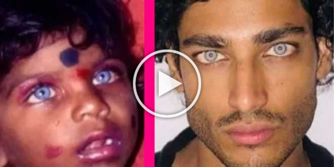 L’isola dei famosi 2021, Akash Kumar ha rifatto gli occhi? Il gesto shock dell’ex naufrago