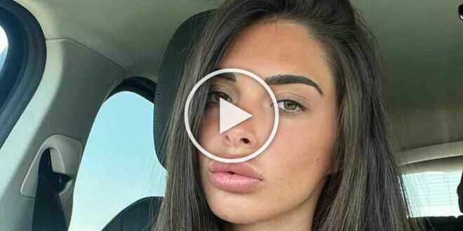 Temptation Island 2023, Greta Rossetti: i nuovi ritocchi estetici diventano virali