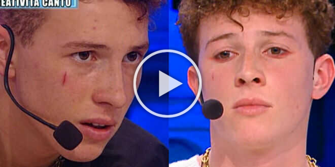 Amici 22, perché Wax ha una cicatrice sulla faccia? Cos’é quel segno rosso