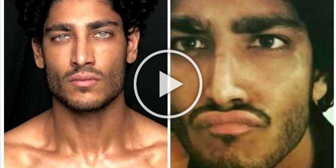 Akash Kumar: ecco qual è la rischiosa operazione agli occhi a cui si sarebbe sottoposto