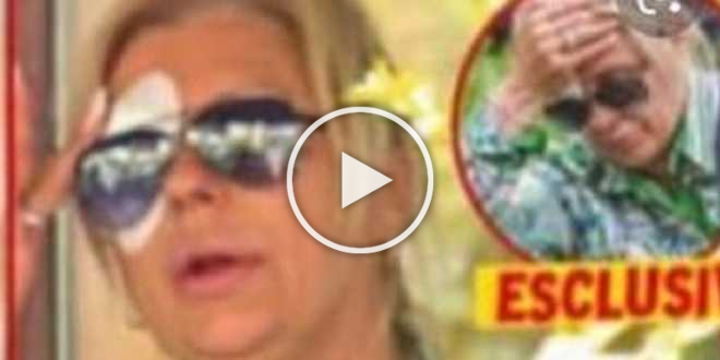 Brutto incidente per Tina Cipollari: l’opinionista con un occhio bendato