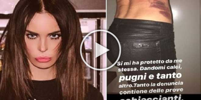 Caso Luigi Favoloso: Nina Moric mostra le terribili foto della presunta violenza