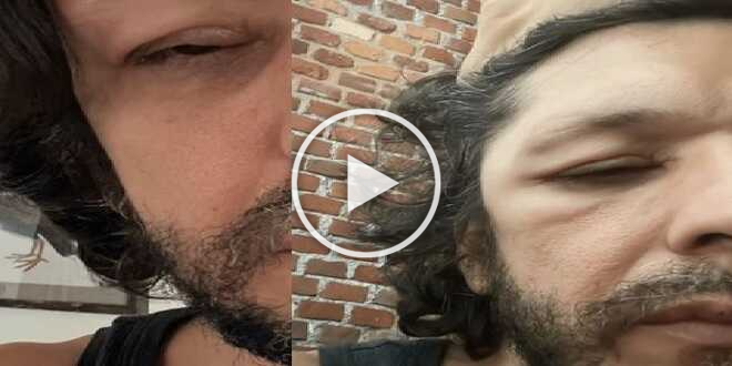 Ermal Meta, sale l’ansia per il suo stato di salute: “Mi si gonfiano parti del corpo”