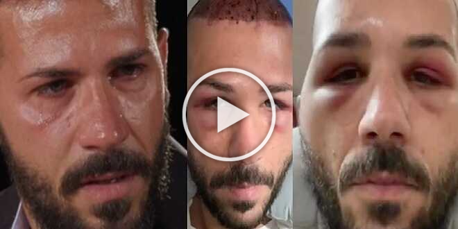 Temptation Island, Federico Rasa dopo il caos in ospedale: “Lasciato solo e peggioravo”