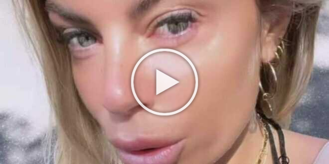 Uomini e Donne gossip, Francesca Del Taglia si gonfia il sedere dal chirurgo