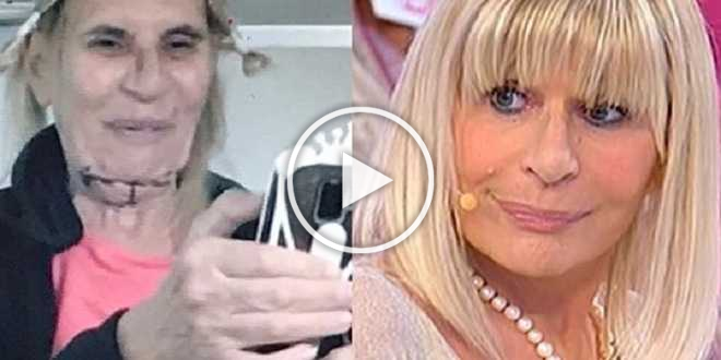 Gemma Galgani, svelati tutti i suoi ritocchini: dagli zigomi ai capelli
