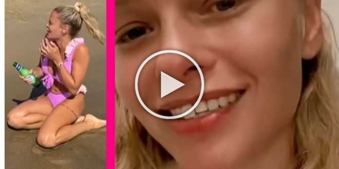 Giulia Provvedi cade e si rompe un dente in diretta: l’incidente è virale