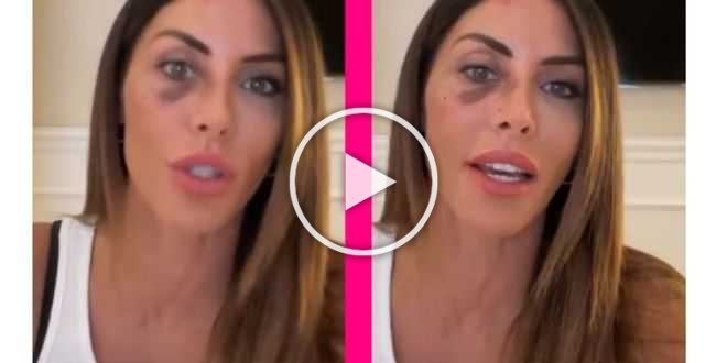Guendalina Tavassi si sbottona sulla violenza subita: “Ho reagito così”
