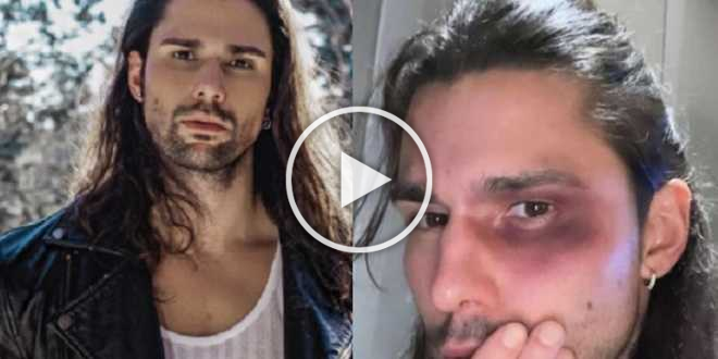 Luca Onestini malmenato dai tifosi del PSG: occhio nero e corsa all’ospedale