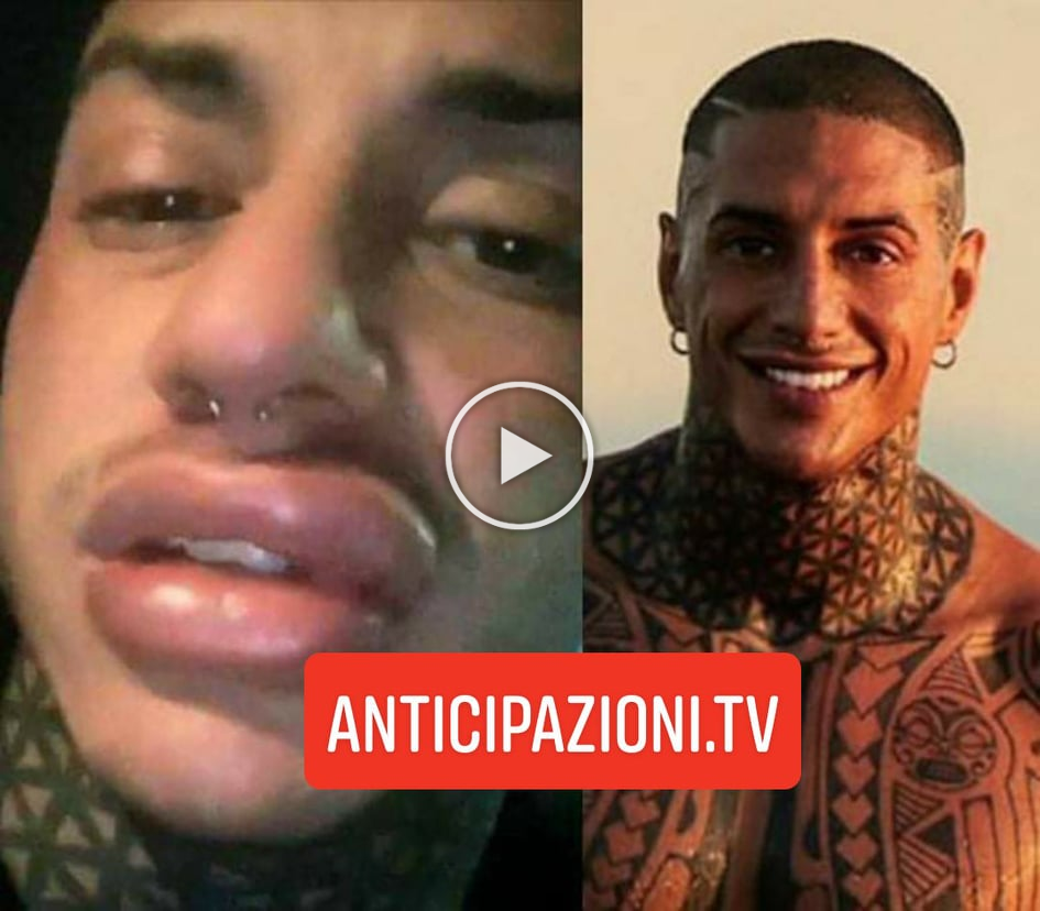 Nuovo dramma per Francesco Chiofalo: la corsa al pronto soccorso e il ricovero