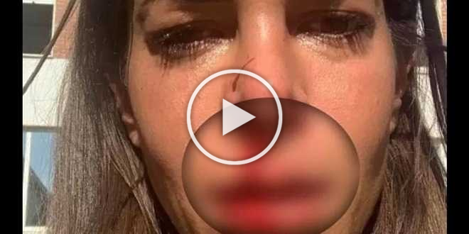 Protagonista di Temptation Island aggredita da padre: le foto shock del sangue