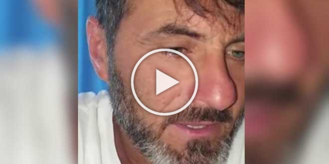 Sossio Aruta irriconoscibile su Instagram: che ha fatto alla faccia?