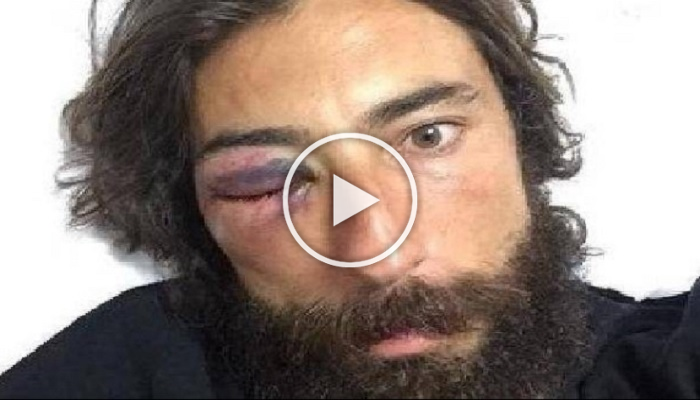 Striscia la Notizia: Vittorio Brumotti picchiato in strada a Pescara!