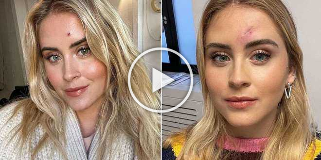 Valentina Ferragni rivela i risultati delle analisi: “Era un tumore maligno”