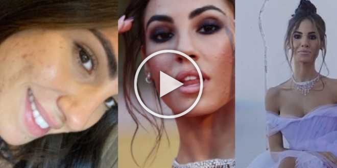 Venezia 77, Giulia De Lellis spiazza con l’acne in bella vista