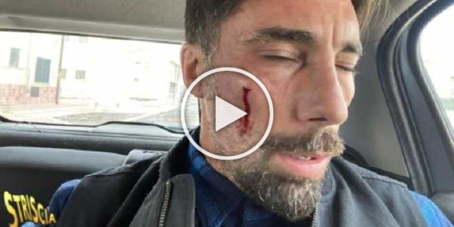 Striscia la Notizia, Vittorio Brumotti massacrato di botte: la prognosi shock